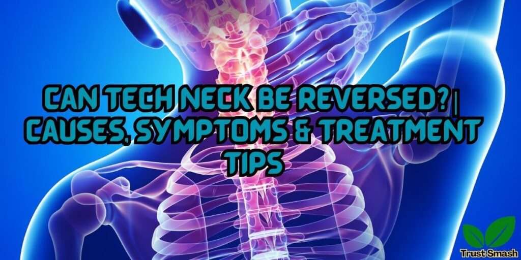 Can tech neck be reversed